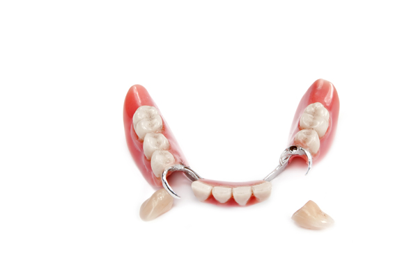 Things To Ask About Partial Dentures Repair